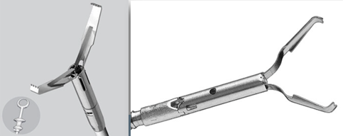 内镜夹怎么不掉切完息肉后，留在肚子里的“金属夹子”，最后去哪儿了？_https://www.jmylbn.com_新闻资讯_第3张