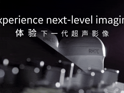 VOlusonE什么彩超机刷爆哈尔滨孕妈圈的GE-E22四维彩超，到底有多神奇？_https://www.jmylbn.com_新闻资讯_第1张