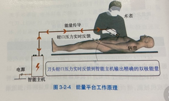 为什么手术用电刀手术室大讲堂第六期——电外科安全_https://www.jmylbn.com_新闻资讯_第4张