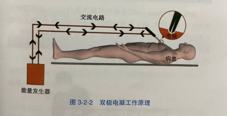 为什么手术用电刀手术室大讲堂第六期——电外科安全_https://www.jmylbn.com_新闻资讯_第2张