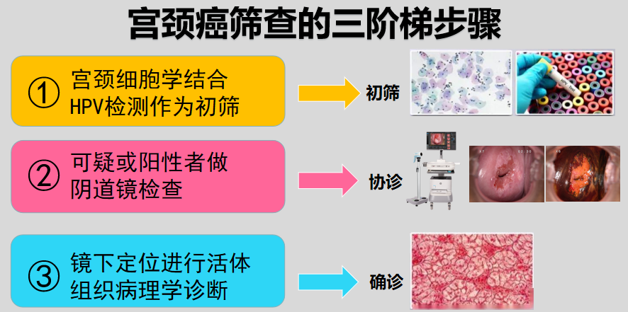宫颈活检取样怎么取宫颈癌二级预防（筛查）_https://www.jmylbn.com_新闻资讯_第1张