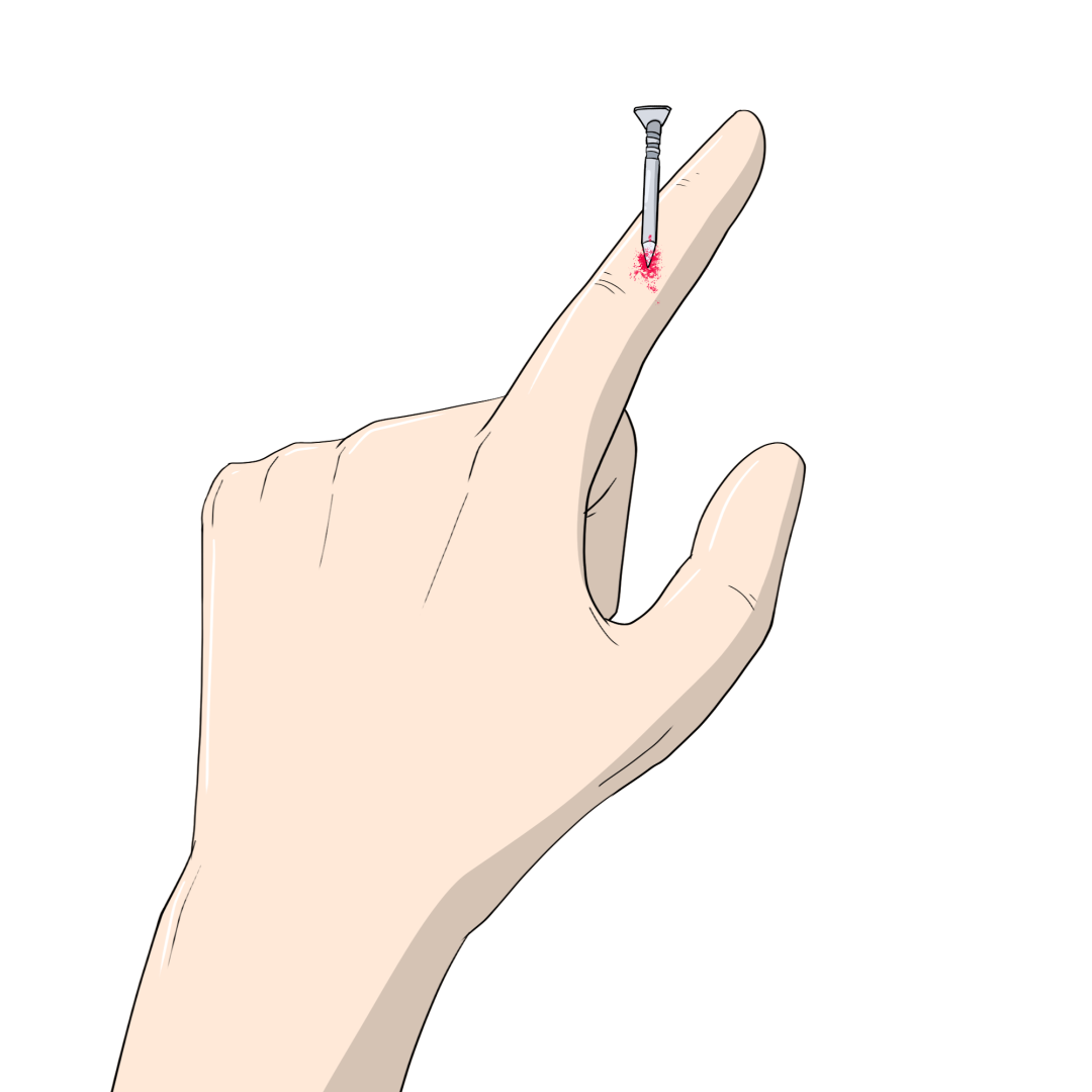 单质银为什么能抗菌“小伤口”也能致死？伤口消毒用什么，看这一篇就够了！_https://www.jmylbn.com_新闻资讯_第14张