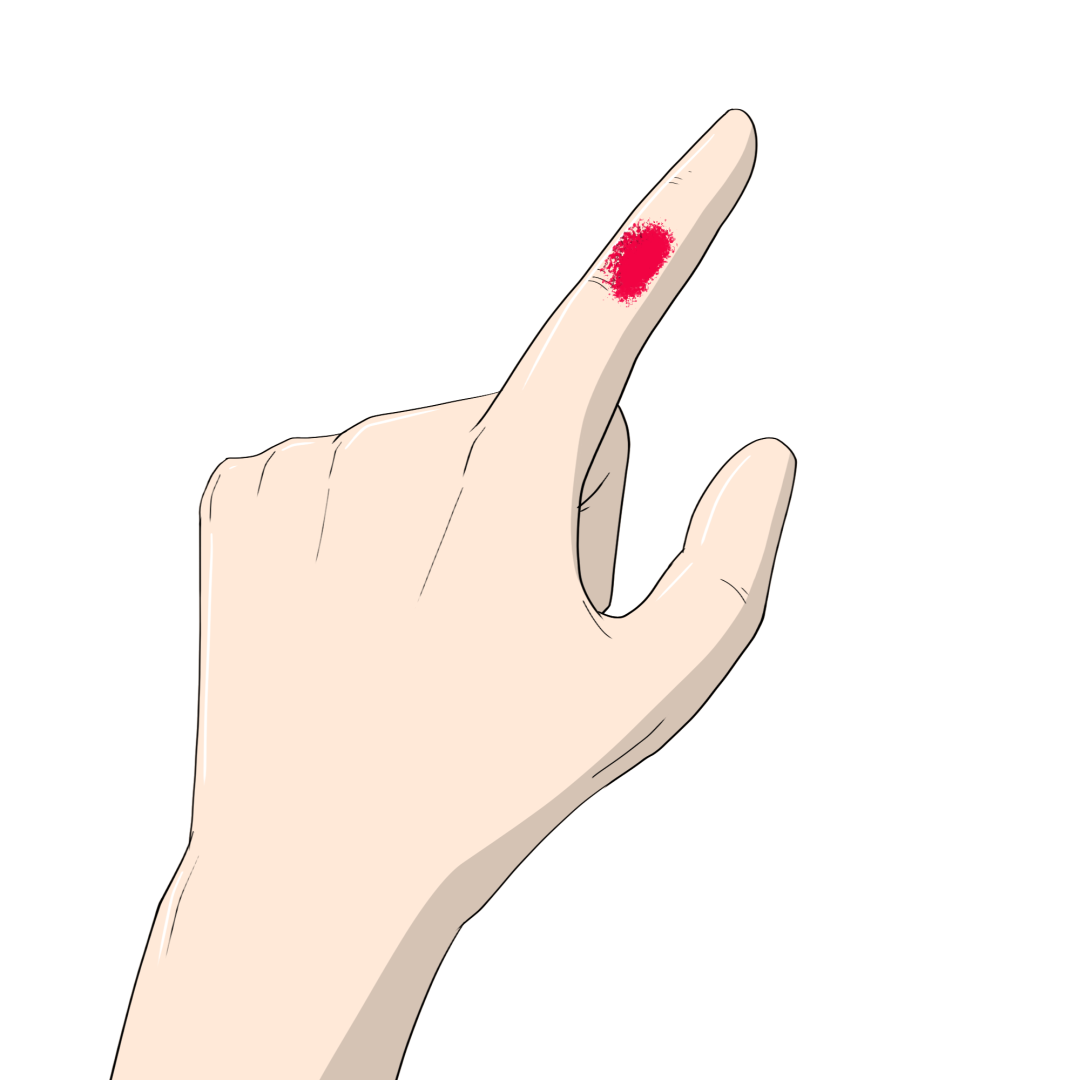 单质银为什么能抗菌“小伤口”也能致死？伤口消毒用什么，看这一篇就够了！_https://www.jmylbn.com_新闻资讯_第12张