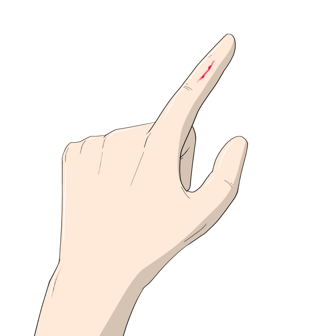 单质银为什么能抗菌“小伤口”也能致死？伤口消毒用什么，看这一篇就够了！_https://www.jmylbn.com_新闻资讯_第13张