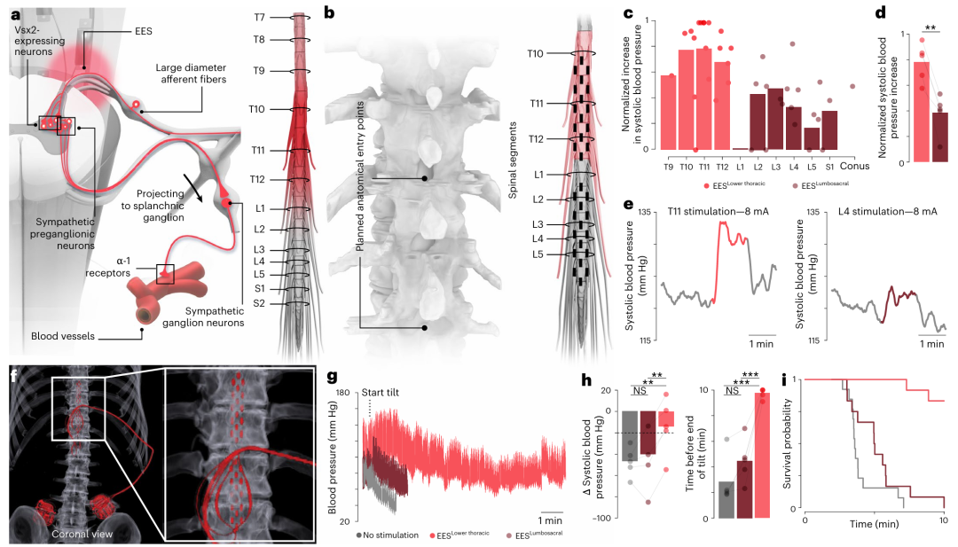 Med怎么电写Nat+Nat Med ｜ 破译脊髓损伤后血压紊乱的“神经密码”：揭示对抗性神经元结构，实现仿生电刺激精准双向调控_https://www.jmylbn.com_新闻资讯_第6张