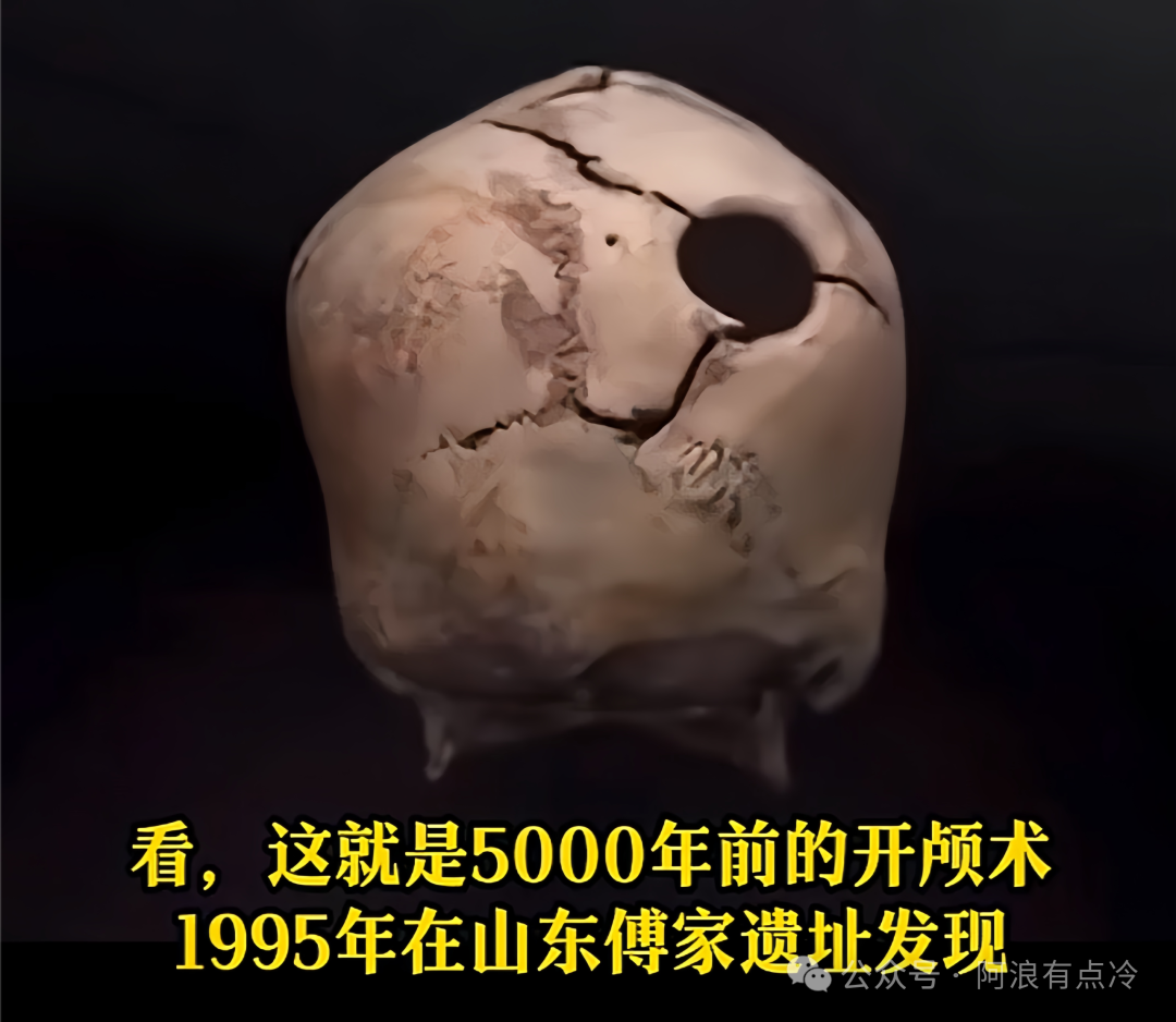 中医5000年手术史，被我们忘得一干二净