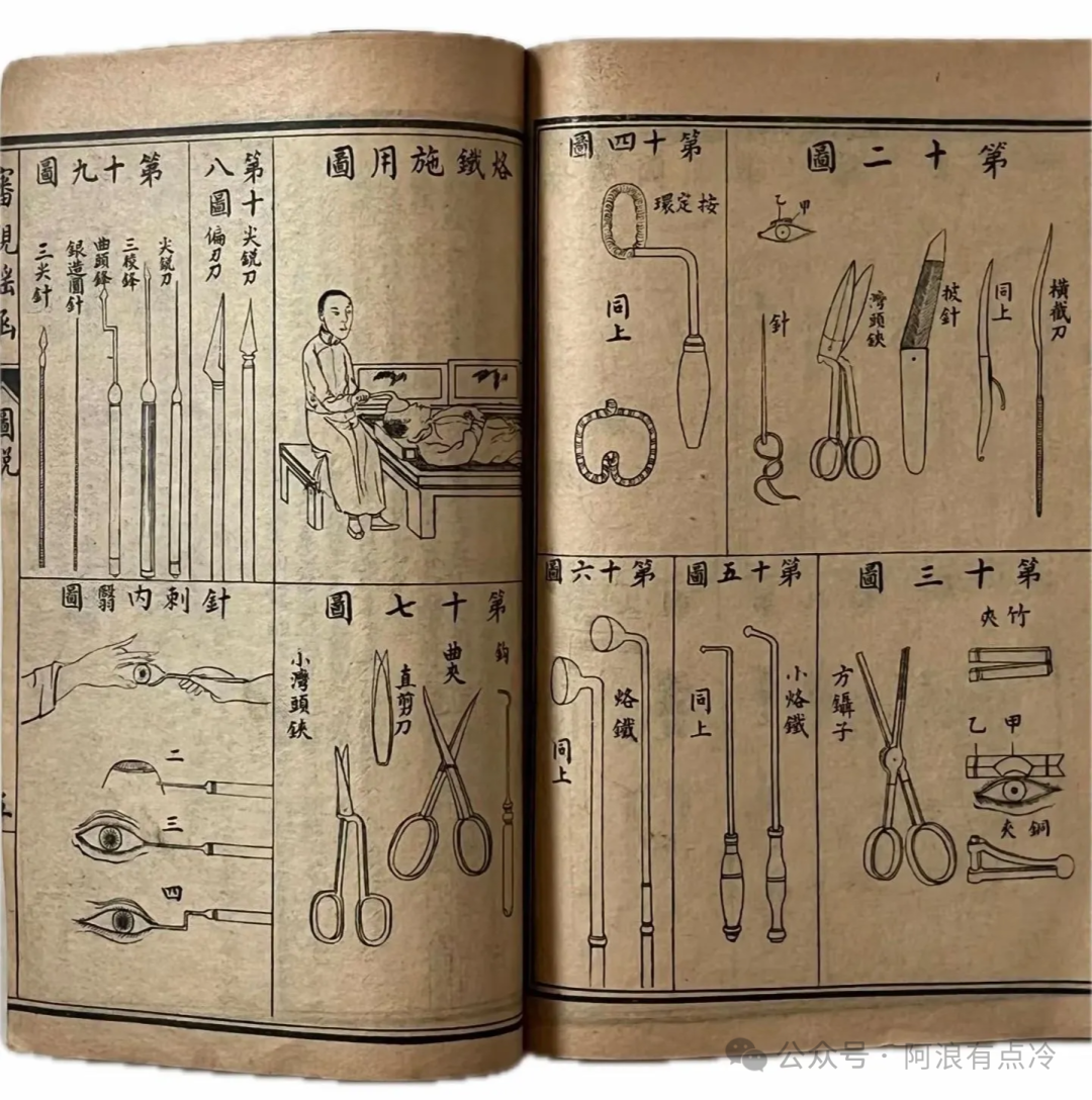 中医5000年手术史，被我们忘得一干二净