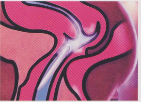 妇科臭氧治疗仪怎么用治疗妇科炎症利器——一体式臭氧妇科治疗仪_https://www.jmylbn.com_新闻资讯_第4张