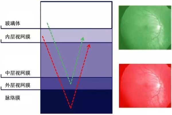 眼底照相机怎么眼底一张照  眼疾早知道——我院眼科引进欧宝超广角眼底照像机_https://www.jmylbn.com_新闻资讯_第20张