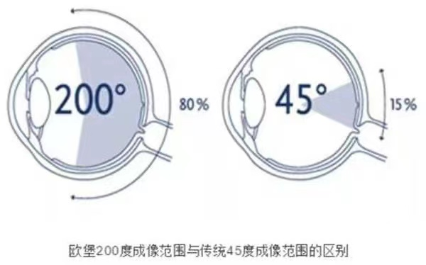 眼底照相机怎么眼底一张照  眼疾早知道——我院眼科引进欧宝超广角眼底照像机_https://www.jmylbn.com_新闻资讯_第17张