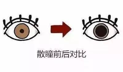 眼底照相机怎么眼底一张照  眼疾早知道——我院眼科引进欧宝超广角眼底照像机_https://www.jmylbn.com_新闻资讯_第11张