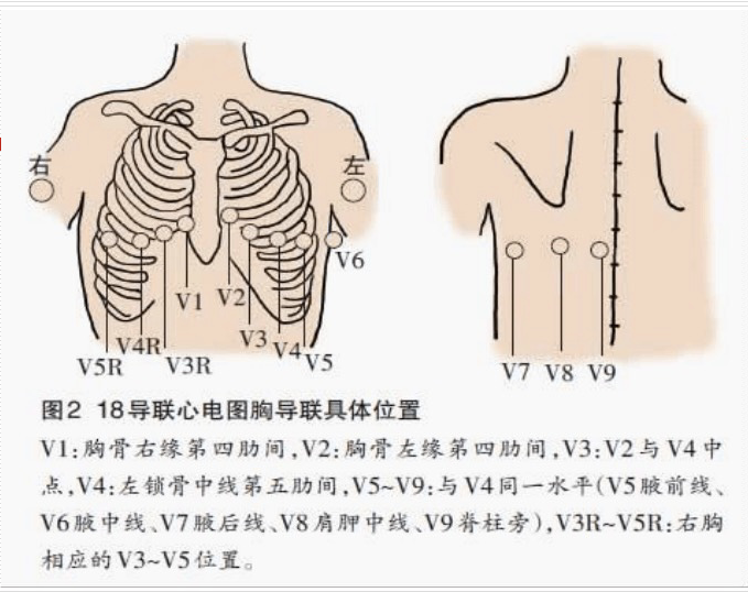 十二道心电图怎么检查好消息！我院可开展十八导联心电图检查啦！_https://www.jmylbn.com_新闻资讯_第7张