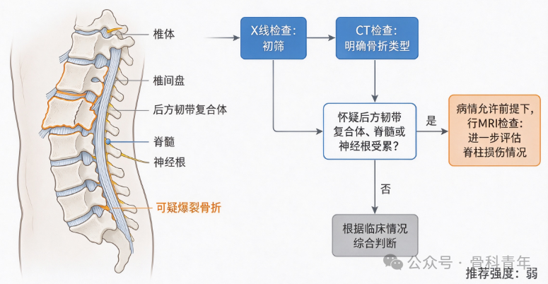 【指南与共识】成人胸腰段爆裂骨折合并急性脊髓损伤诊疗指南（2026版）