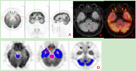 医疗 mr是什么PET／MR---引领我们进入更安全和精准高效的医疗新时代_https://www.jmylbn.com_新闻资讯_第3张