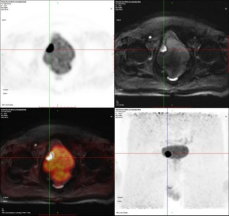 医疗 mr是什么PET／MR---引领我们进入更安全和精准高效的医疗新时代_https://www.jmylbn.com_新闻资讯_第1张