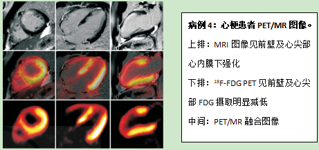 医疗 mr是什么PET／MR---引领我们进入更安全和精准高效的医疗新时代_https://www.jmylbn.com_新闻资讯_第4张
