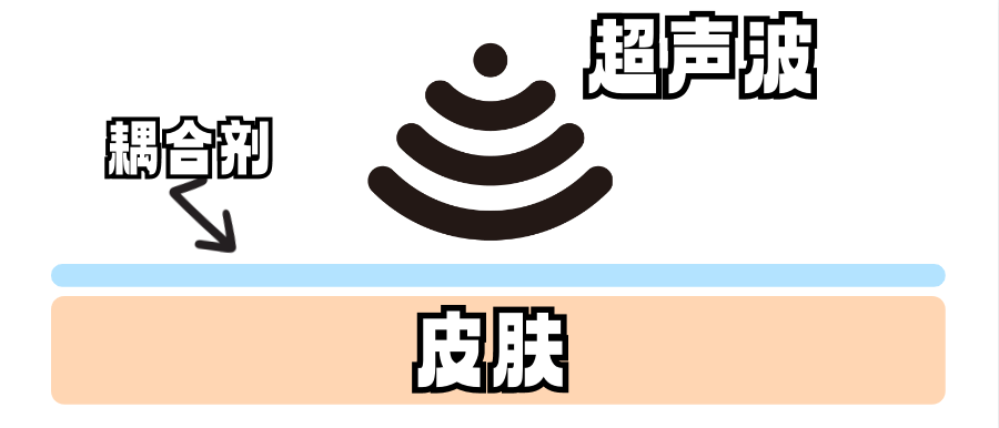 b超检查为什么涂耦合剂做B超时涂的凉凉的凝胶，原来叫作“耦合剂”_https://www.jmylbn.com_新闻资讯_第3张