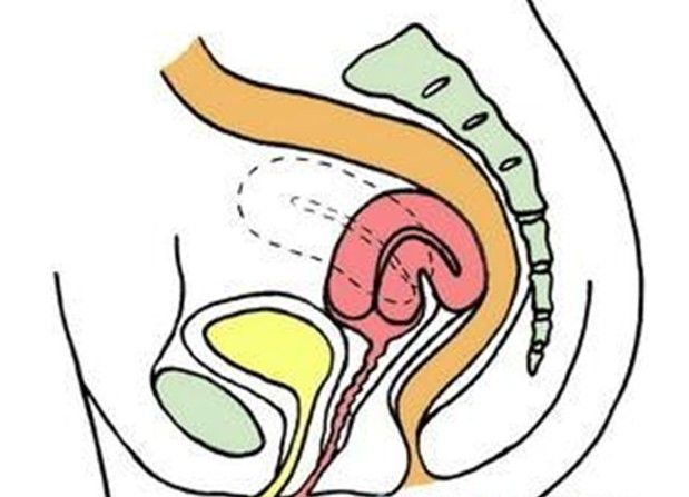 二氧化碳(co2)激光治疗是什么【苏州市中医医院丨科普园地】妇科CO2激光治疗，让你重获光彩！_https://www.jmylbn.com_新闻资讯_第8张