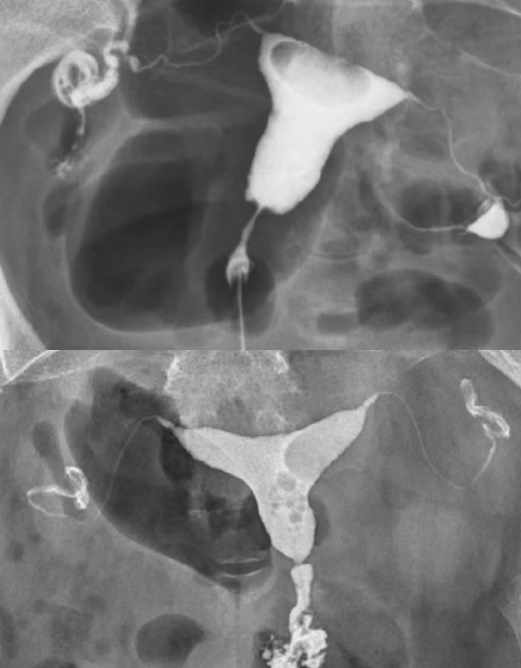 数字胃肠透视怎么做【新设备】数字胃肠机——全能型检查小助手_https://www.jmylbn.com_新闻资讯_第12张