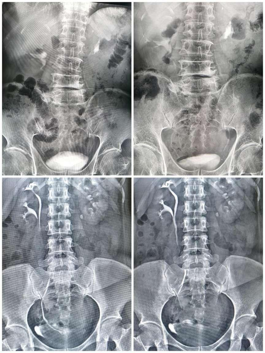 数字胃肠透视怎么做【新设备】数字胃肠机——全能型检查小助手_https://www.jmylbn.com_新闻资讯_第10张