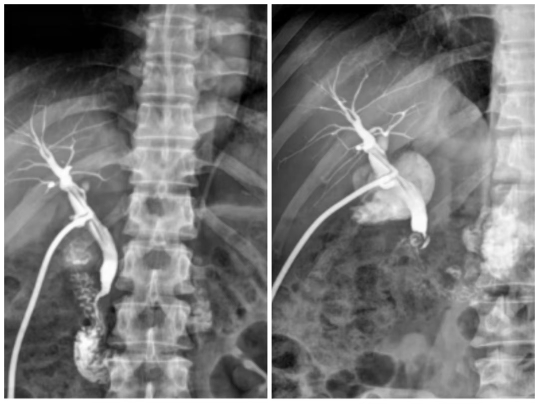 数字胃肠透视怎么做【新设备】数字胃肠机——全能型检查小助手_https://www.jmylbn.com_新闻资讯_第13张