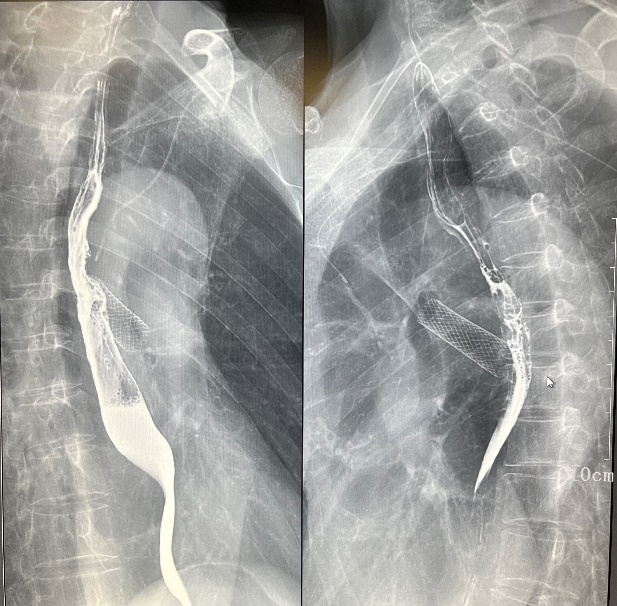 数字胃肠透视怎么做【新设备】数字胃肠机——全能型检查小助手_https://www.jmylbn.com_新闻资讯_第4张