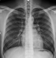 x光材质怎么调【科普加油站】放射检查穿对衣服，让健康“一目了然”_https://www.jmylbn.com_新闻资讯_第5张