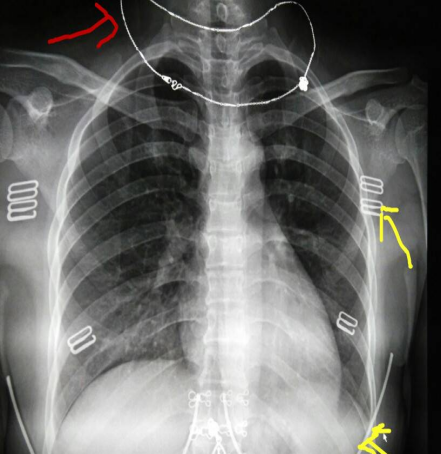 x光材质怎么调【科普加油站】放射检查穿对衣服，让健康“一目了然”_https://www.jmylbn.com_新闻资讯_第7张