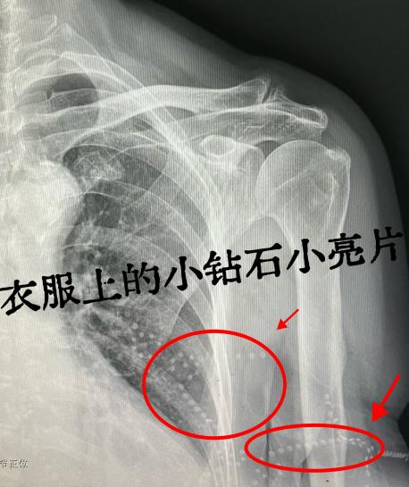 x光材质怎么调【科普加油站】放射检查穿对衣服，让健康“一目了然”_https://www.jmylbn.com_新闻资讯_第10张