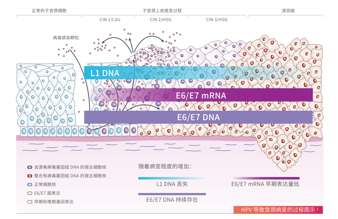 hpvdna分型分为什么型人乳头瘤病毒HPV25分型检测_https://www.jmylbn.com_新闻资讯_第4张