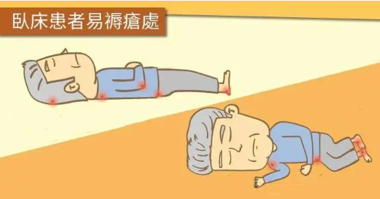 卧床老人怎么护理老年人长期卧床如何护理？_https://www.jmylbn.com_新闻资讯_第3张