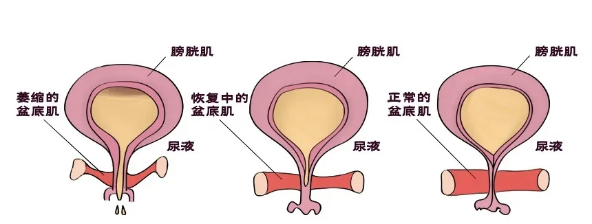 妇科磁疗怎么用的【好消息】盆底健康新起点！大连市中医医院盆底修复中心7月2日正式开诊啦！_https://www.jmylbn.com_新闻资讯_第10张