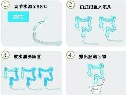 结肠水疗仪怎么用【特色诊疗】结肠水疗——躺着做的肠道SPA_https://www.jmylbn.com_新闻资讯_第5张