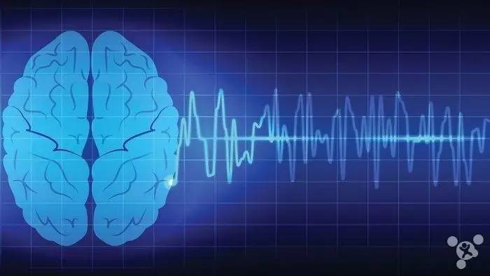 动态脑电图怎么看带您了解动态脑电图_https://www.jmylbn.com_新闻资讯_第4张