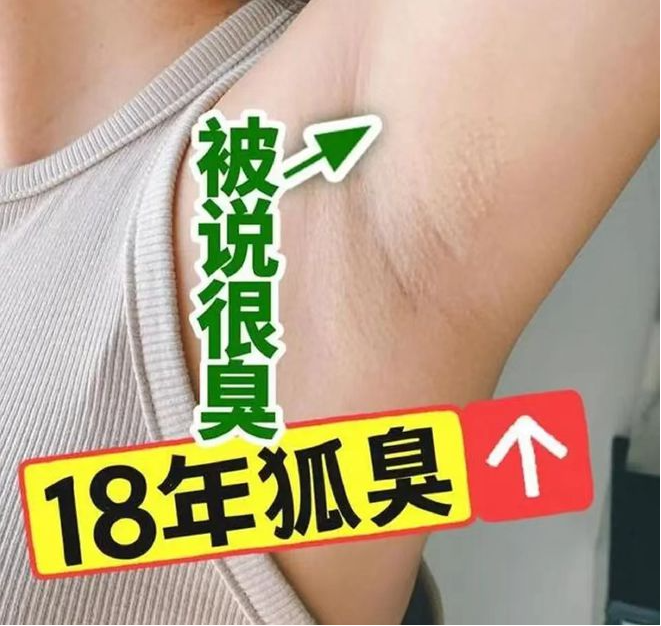 狐臭困扰不再有:全面解析原因,影响及治疗方法!