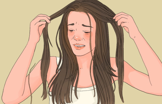 【肤康科普】头发油的很快还掉发是什么原因？