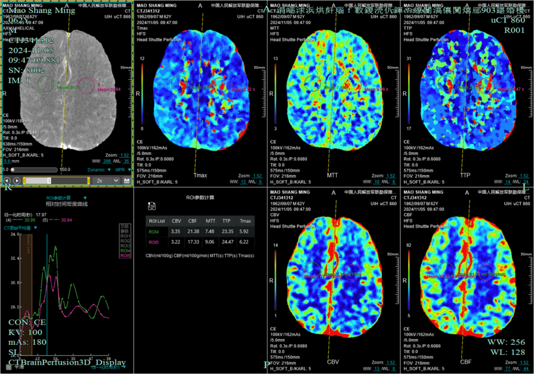 联影有哪些CT患者福音，再添利器！第903医院引进联影160排320层UCT天河860高端螺旋CT_https://www.jmylbn.com_新闻资讯_第12张