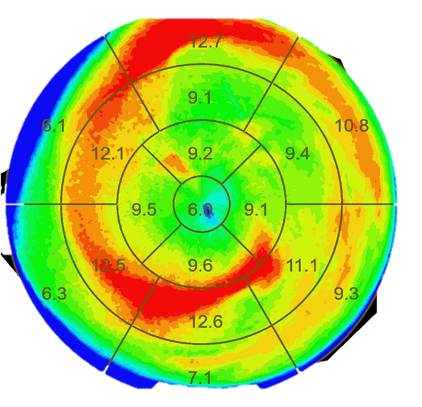 联影有哪些CT患者福音，再添利器！第903医院引进联影160排320层UCT天河860高端螺旋CT_https://www.jmylbn.com_新闻资讯_第10张