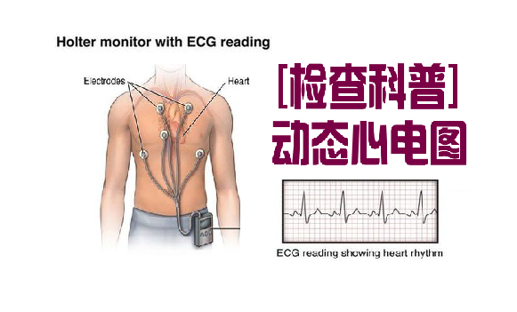 动态心电图仪器怎么看超声诊断与电生理科新开展项目：动态心电图检查_https://www.jmylbn.com_新闻资讯_第1张