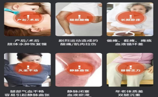 全科诊疗仪是什么神奇的“防栓利器”：间歇充气加压装置｜安阳地区医院全科医疗科特色诊疗系列_https://www.jmylbn.com_新闻资讯_第5张