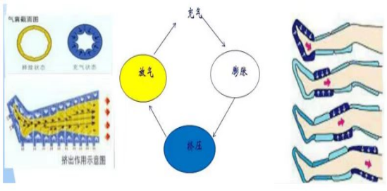 全科诊疗仪是什么神奇的“防栓利器”：间歇充气加压装置｜安阳地区医院全科医疗科特色诊疗系列_https://www.jmylbn.com_新闻资讯_第6张