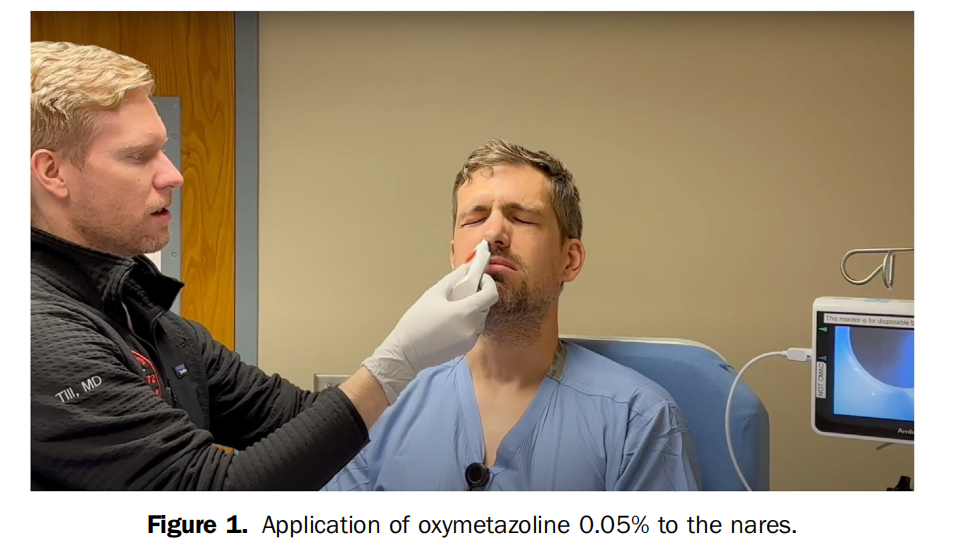 气管插管纱布怎么垫急诊仅0.4%？梅奥专家揭秘：清醒插管85%成功率的救命法则！(附详细图解)_https://www.jmylbn.com_新闻资讯_第10张