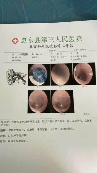 耳鼻喉内镜是什么科【医疗动态】五官科的“火眼金睛”——内窥镜检查_https://www.jmylbn.com_新闻资讯_第17张