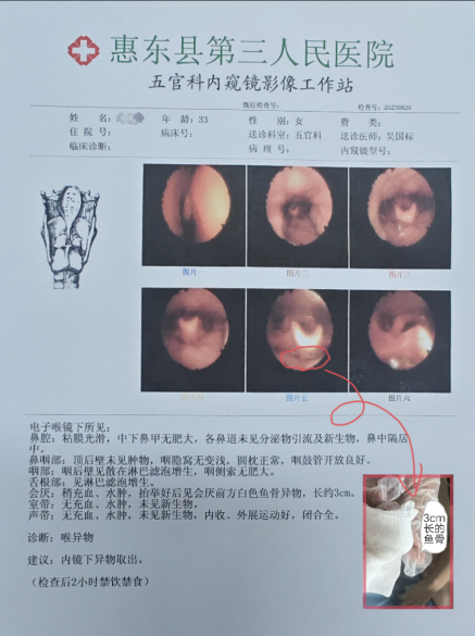 耳鼻喉内镜是什么科【医疗动态】五官科的“火眼金睛”——内窥镜检查_https://www.jmylbn.com_新闻资讯_第18张