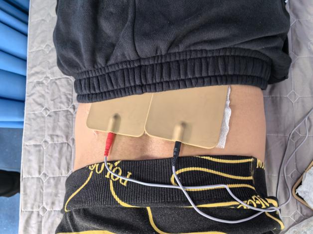 中频为什么可以消炎【惠东三院康复治疗】疼痛克星：中频脉冲电治疗_https://www.jmylbn.com_新闻资讯_第4张