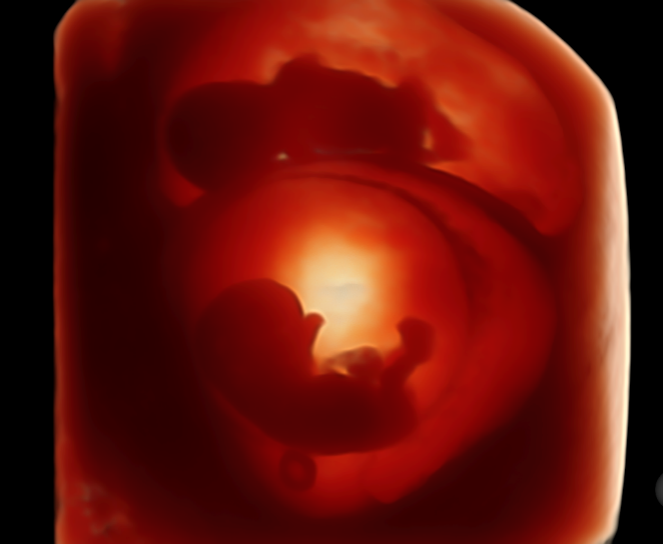 VOlusonE什么彩超机孕妈妈的福音——金普妇幼首家引进高端四维彩超-GE-Voluson金标E10_https://www.jmylbn.com_新闻资讯_第7张