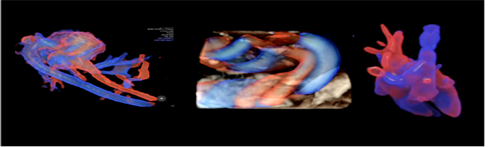 VOlusonE什么彩超机孕妈妈的福音——金普妇幼首家引进高端四维彩超-GE-Voluson金标E10_https://www.jmylbn.com_新闻资讯_第14张