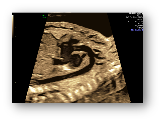 VOlusonE什么彩超机孕妈妈的福音——金普妇幼首家引进高端四维彩超-GE-Voluson金标E10_https://www.jmylbn.com_新闻资讯_第18张