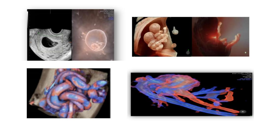 VOlusonE什么彩超机孕妈妈的福音——金普妇幼首家引进高端四维彩超-GE-Voluson金标E10_https://www.jmylbn.com_新闻资讯_第10张