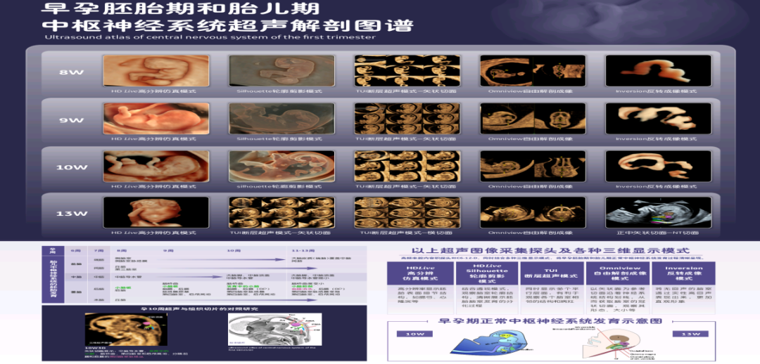 VOlusonE什么彩超机孕妈妈的福音——金普妇幼首家引进高端四维彩超-GE-Voluson金标E10_https://www.jmylbn.com_新闻资讯_第20张